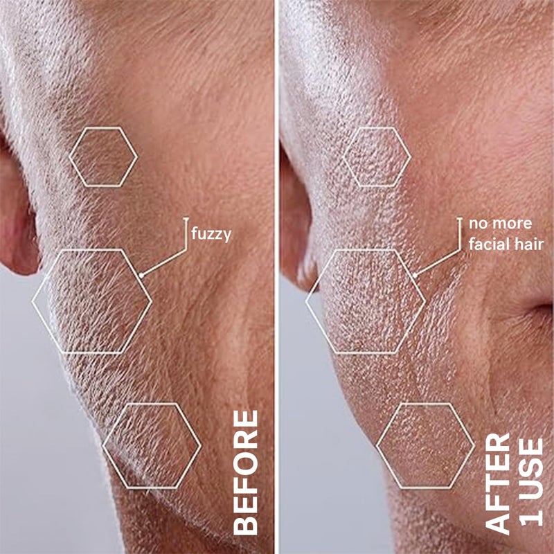 Michael Todd Beauty Sonicsmooth Pro+ Dermaplane Razor for Women Face + Eyebrow Trimmer Dermaplaning System w/LED Light Peach Fuzz Remover -16 Dermaplaning Blades & 2 Microsmooth Exfoliation Tips - Image 5